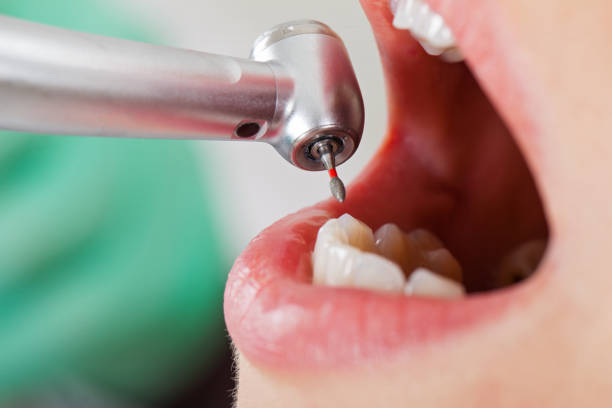 Best Emergency Pediatric Dentist  in Spout Springs, NC
